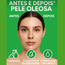 Kit Skincare Anti Oleosidade e Acne Salicílico + Sérum Secativo Dermachem