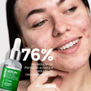 Kit Skincare Limpeza Pele Antioleosidade Pele Oleosa c/ Sérum Faixa e Esponja Promoção